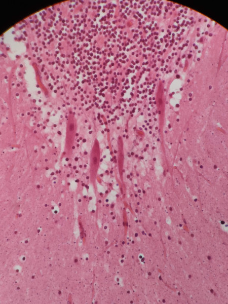  Purkinje Cells - 416 Cerebellum, sec. (Omano OMSK-HH50) via Nikon Eclipse E200 (FEB/12/2019 @ 9:22pm) 