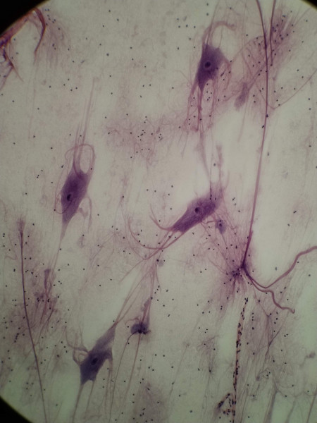  OX Spinal cord; motor nerve cells, smr. HE 4-1 (TRIARCH Prepared Slide) via Nikon Eclipse E200 (FEB/12/2019 @ 3:12pm) 